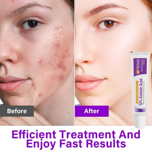 Cross-border E-commerce Azelaic Acid 12% Azelaic Acid Essence Nicotinamide Soothes Skin And Brightens Skin Color