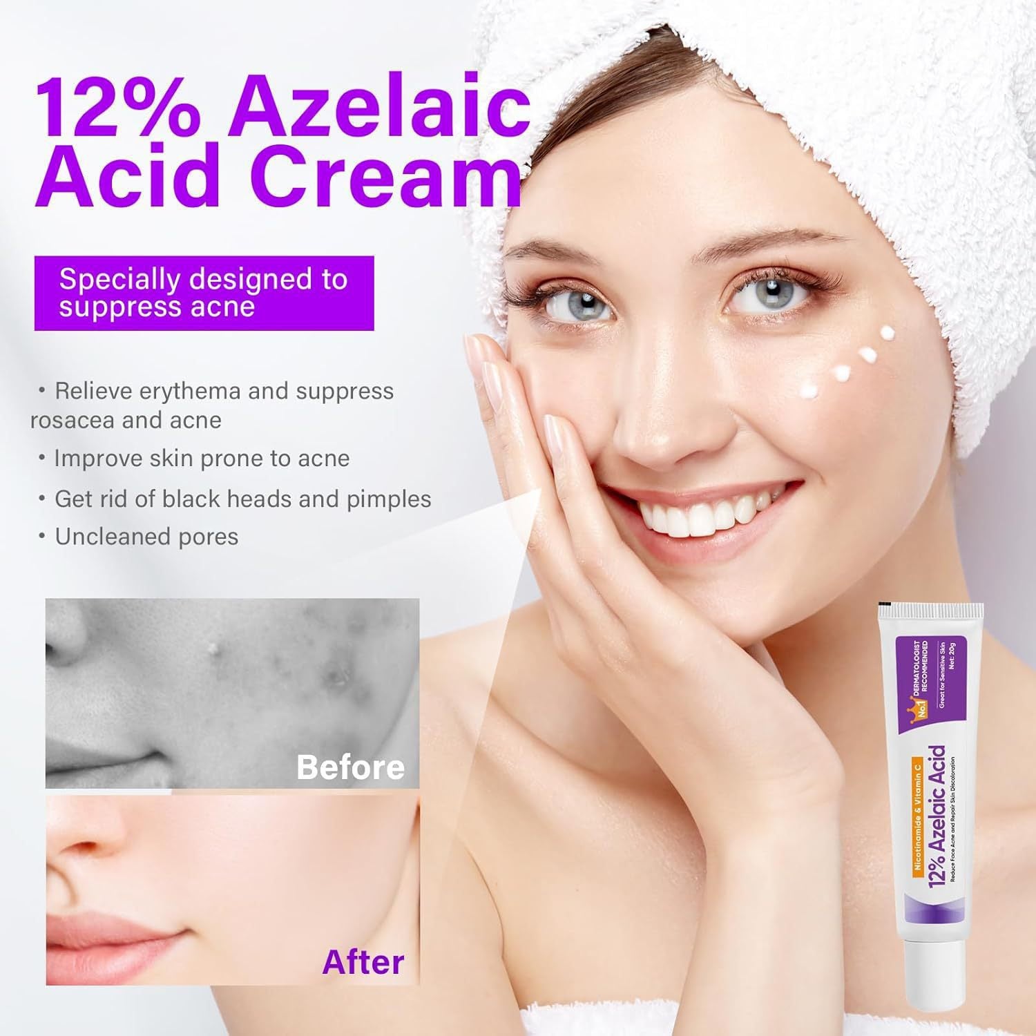 Cross-border E-commerce Azelaic Acid 12% Azelaic Acid Essence Nicotinamide Soothes Skin And Brightens Skin Color